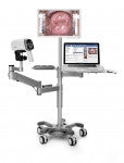 Edan C3A Video Colposcope/Edan C6A Video Colposcope